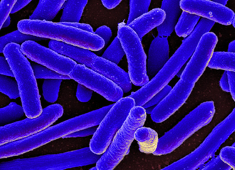 E._coli_Bacteria_(16578744517) source: https://commons.wikimedia.org/wiki/File:E._coli_Bacteria_%2816578744517%29.jpg